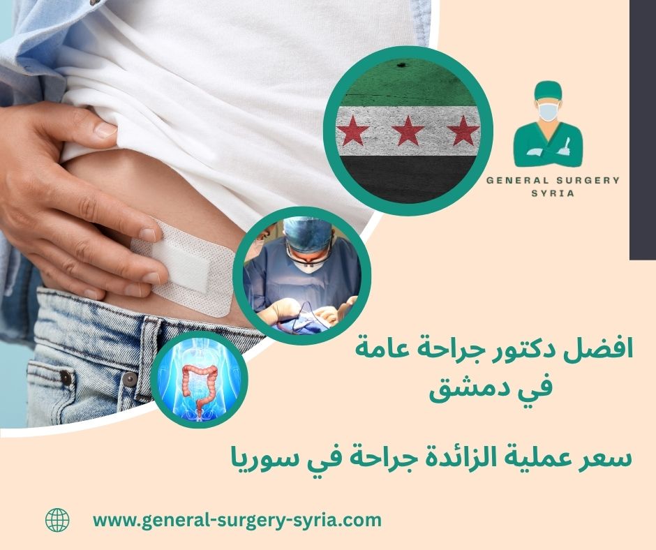 سعر عملية الزائدة جراحة في سوريا سعر عملية الزائدة جراحة في سوريا