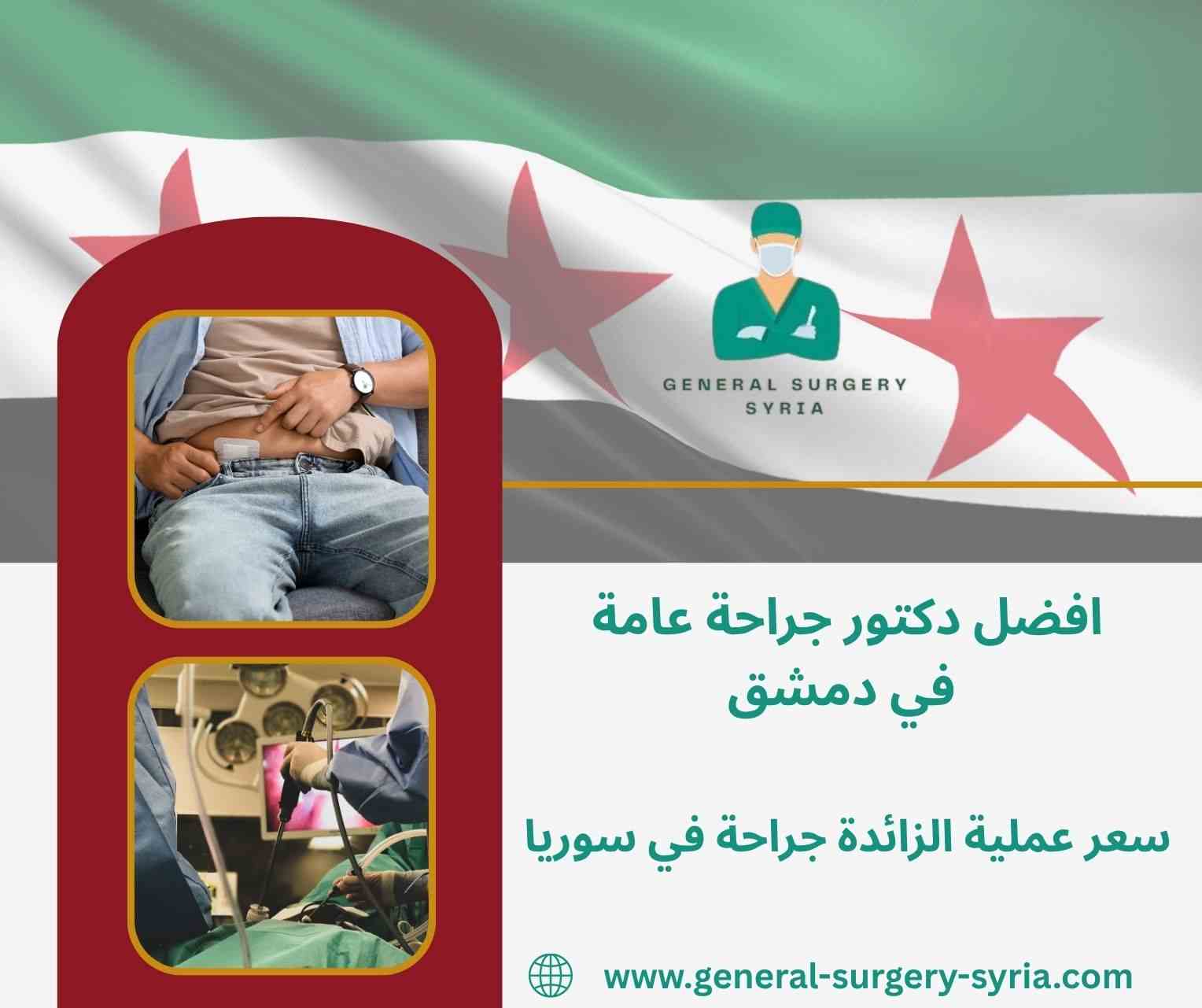 سعر عملية الزائدة بالمنظار في دمشق سعر عملية الزائدة بالمنظار في دمشق