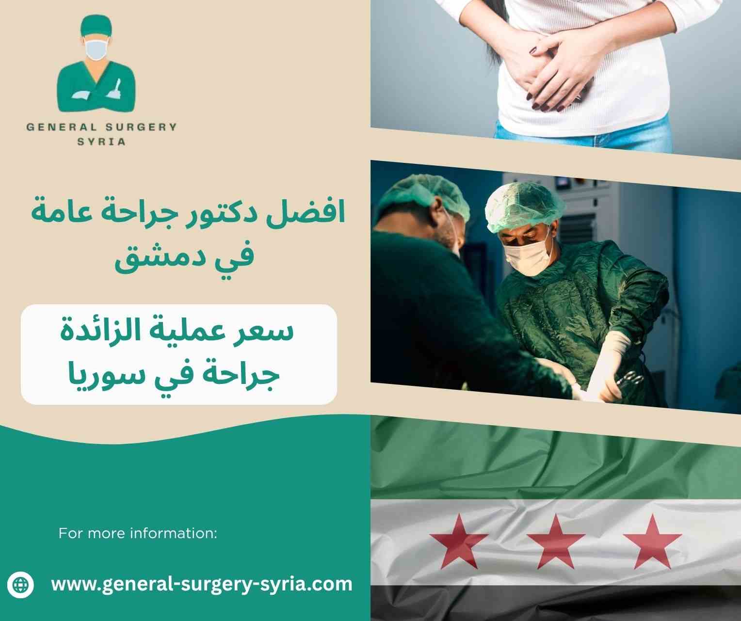 مدة عملية الزائدة بالمنظار مدة عملية الزائدة بالمنظار