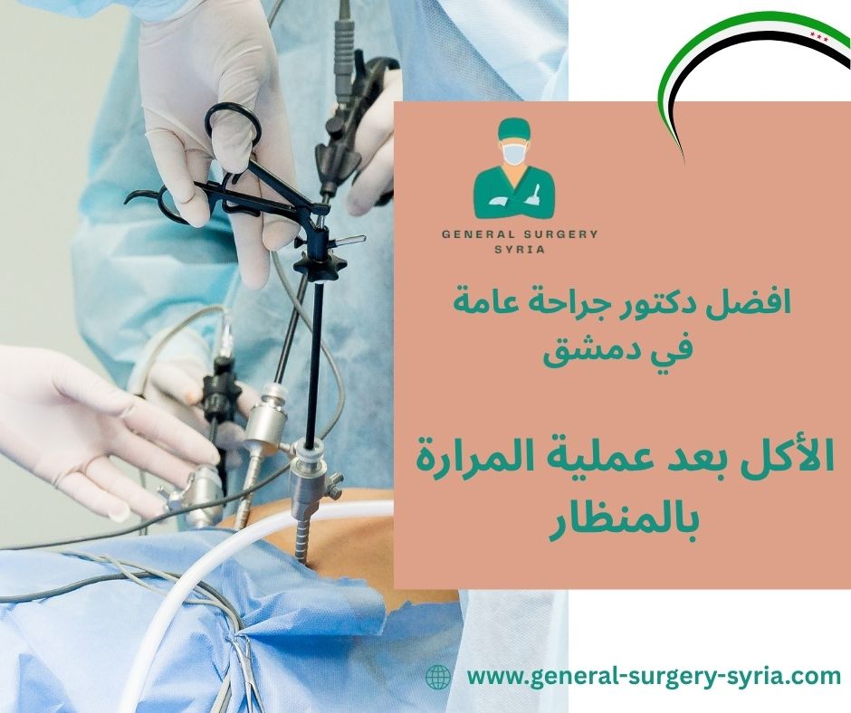 اكل صحي بعد ازالة المرارة