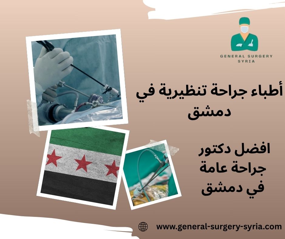 أطباء جراحة تنظيرية في دمشق