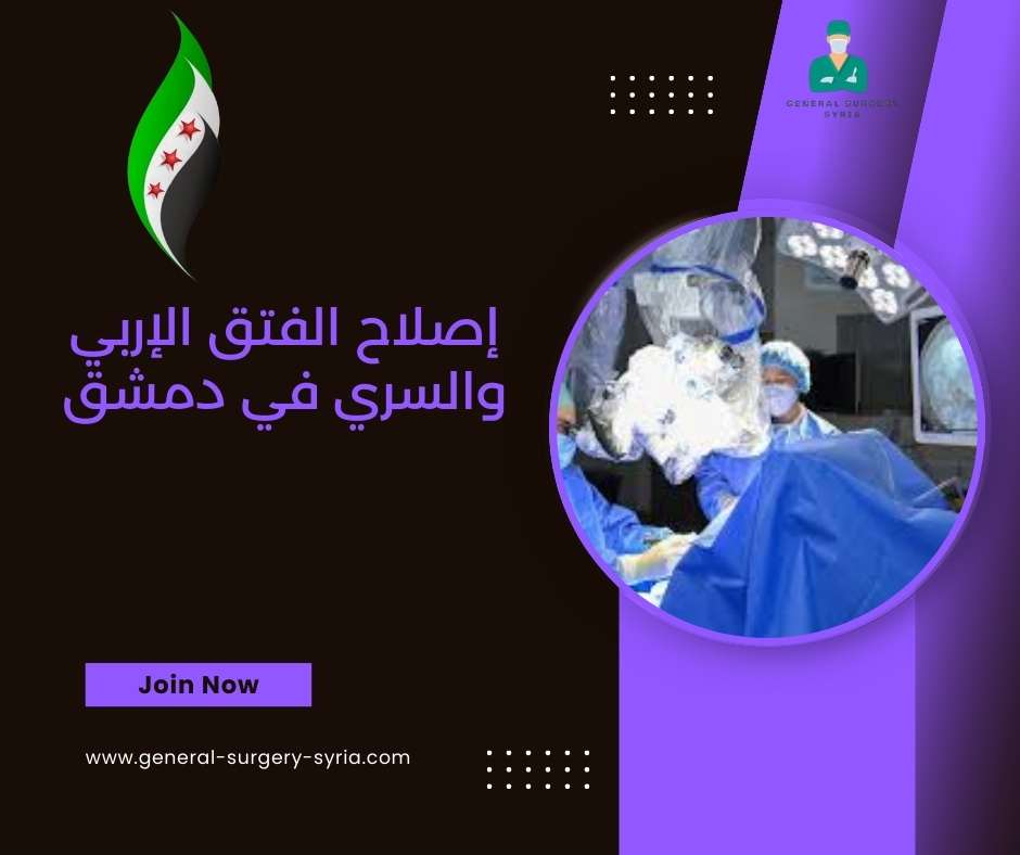 إصلاح الفتق الإربي والسري في دمشق
