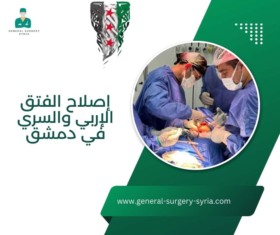 إصلاح الفتق الإربي والسري في دمشق