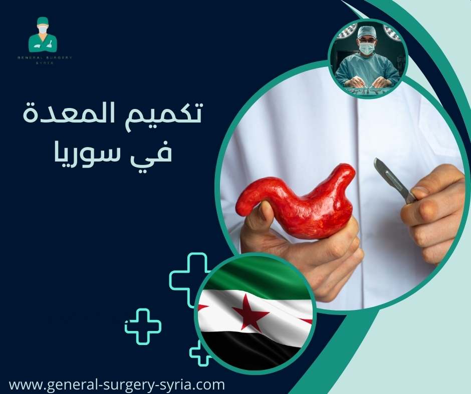 تكميم المعدة في سوريا