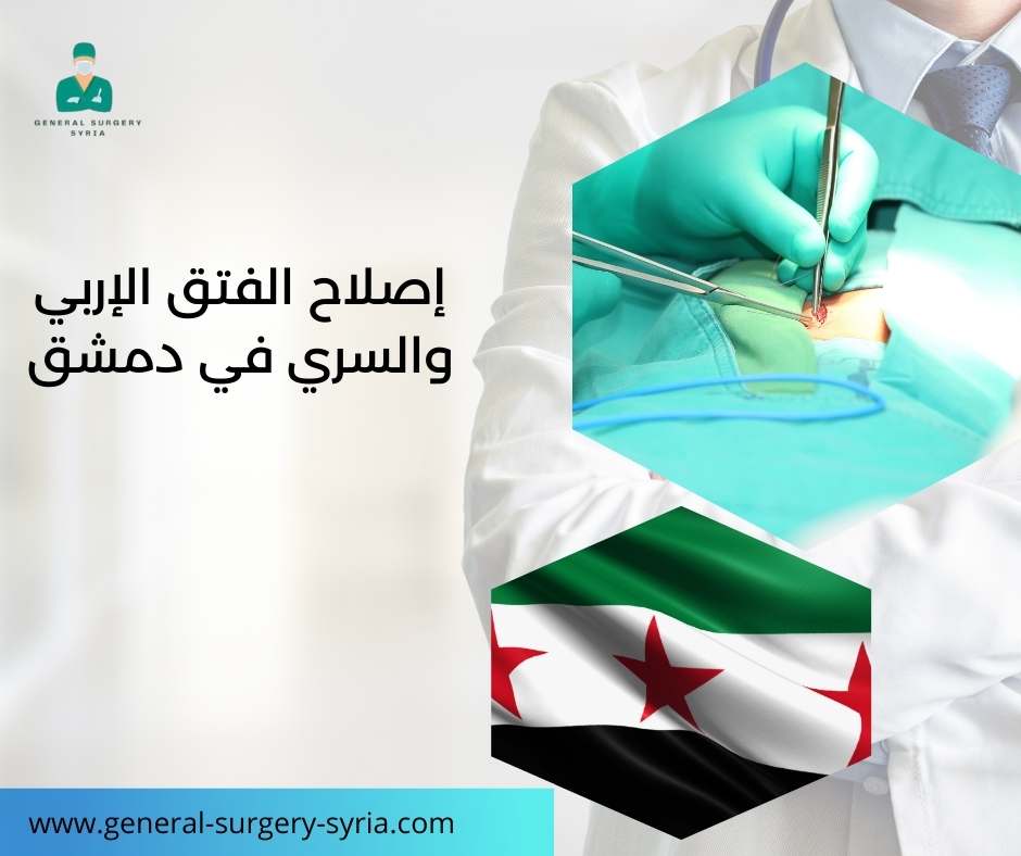 إصلاح الفتق الإربي والسري في دمشق