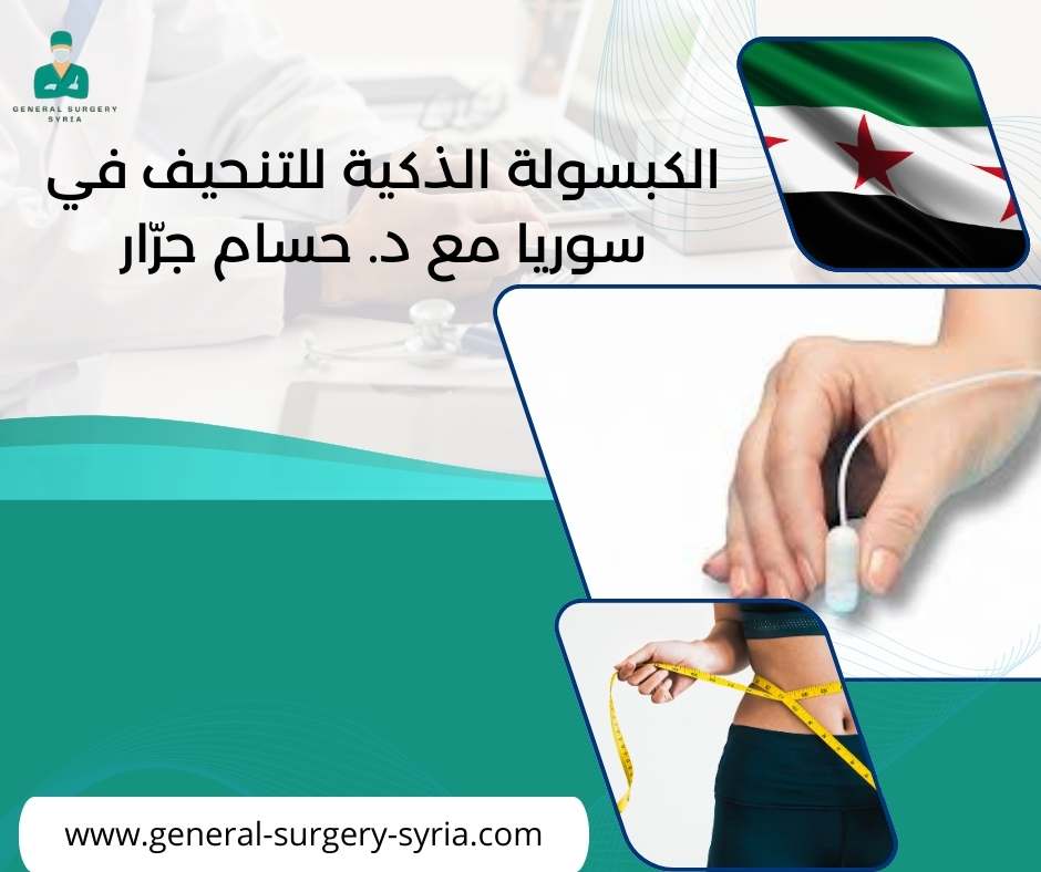 الكبسولة الذكية للتنحيف في سوريا مع د. حسام جرّار