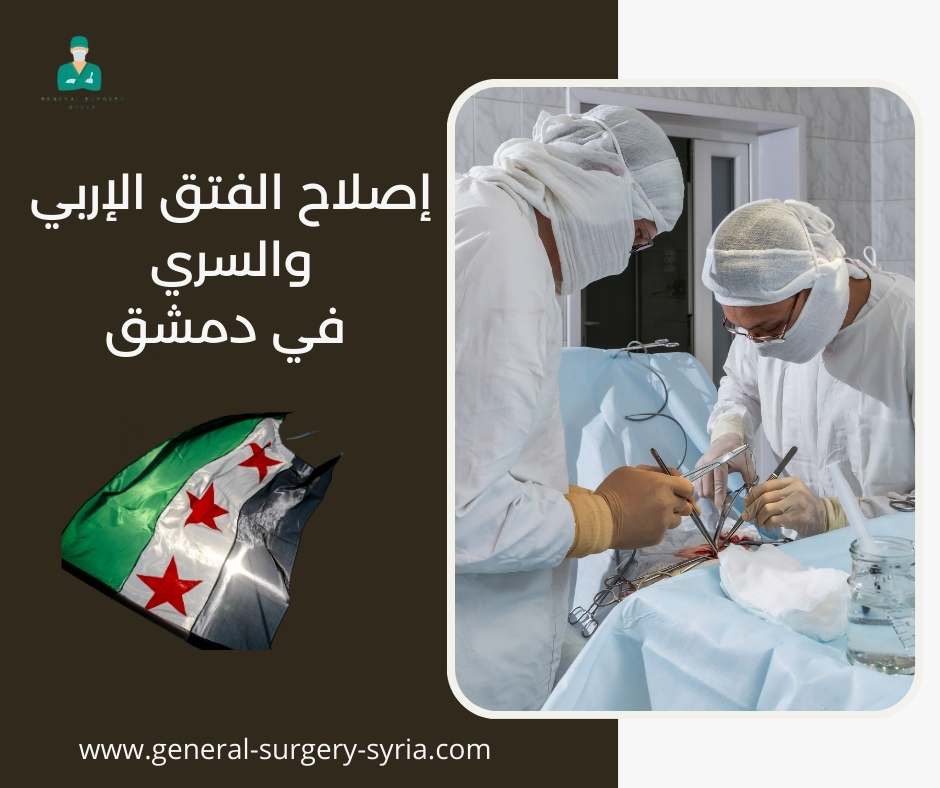 إصلاح الفتق الإربي والسري في دمشق
