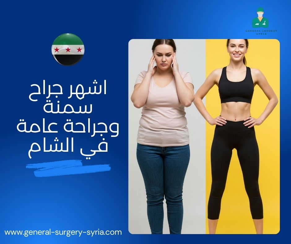 اشهر جراح سمنة وجراحة عامة في الشام